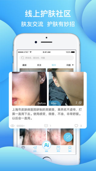 皮肤宝—测肤美容护肤咨询平台
