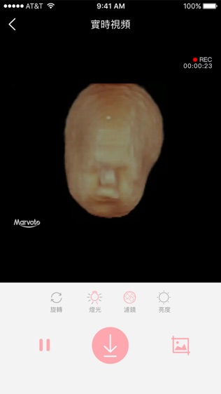 ̥ͼ2