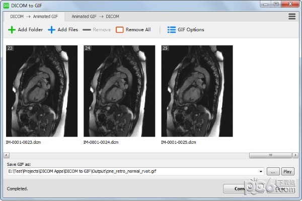 DICOM to GIF(DICOMļתGIF)