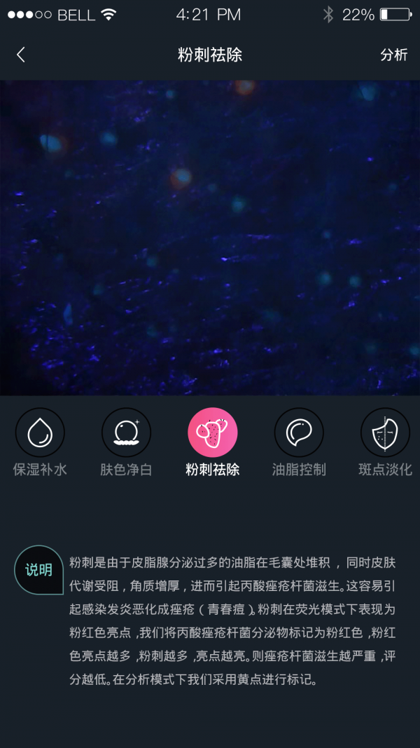 AIͼ2