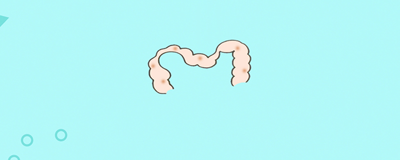 ôϴ
