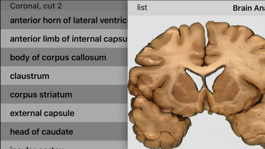 Brain Anatomy