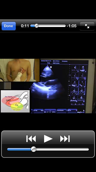 One Minute Ultrasoundͼ1
